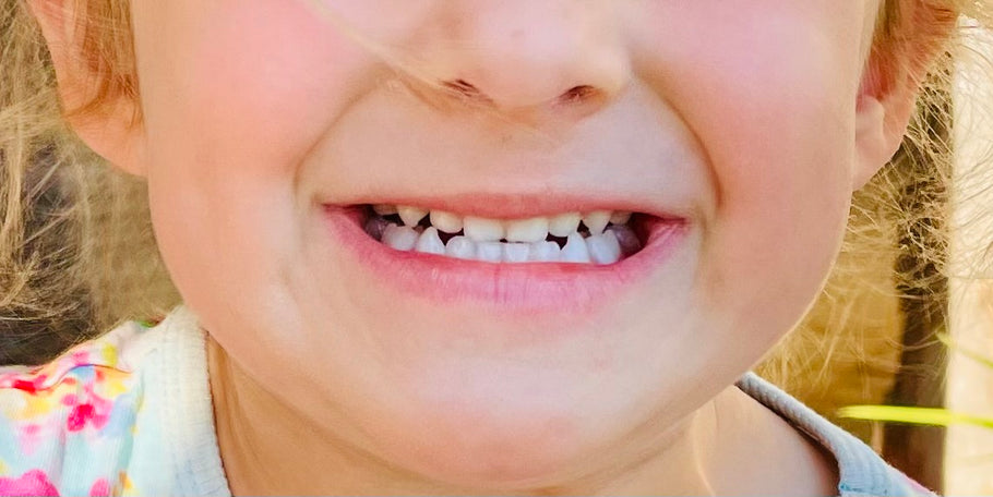Do baby teeth matter?